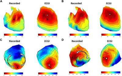 Investigation into the importance of using natural PVCs and pathological models for potential-based ECGI validation